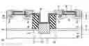 Fig. 01 - Silicon carbide semiconductor device