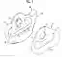 Fig. 02 - Deflection device for a safety belt