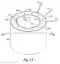 Fig. 02 - Over molded stator