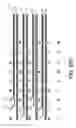 Fig. 30 - Matched-impedance surface-mount technology footprints