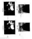 Fig. 12 - Video-based human verification system and method