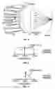 Fig. 06 - Method and apparatus for reducing or eliminating the progression of myopia