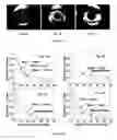 Fig. 03 - Methods for specifying image quality of human eyes from wavefront measurements