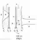 Fig. 02 - Multimode acoustic imaging in cased wells