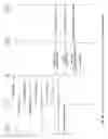 Fig. 13 - Optimally interworking SIP and QSIG call diversion and transfer