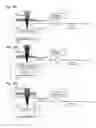 Fig. 05 - Light receiving circuit, semiconductor laser device, and optical pickup device