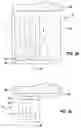 Fig. 04 - X-ray device and X-ray sensitive camera for panoramic tomography and 3D shots