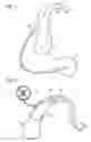 Fig. 02 - Hearing aid