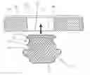 Fig. 01 - Fixation element for an implantable microphone