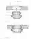 Fig. 05 - Fixation element for an implantable microphone
