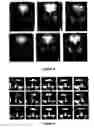 Fig. 04 - Robust face registration via multiple face prototypes synthesis