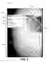 Fig. 03 - System aid for digital radiographic image quality verification