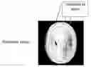 Fig. 01 - Method for image intensity correction using extrapolation and adaptive smoothing