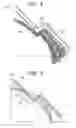 Fig. 04 - Developing apparatus
