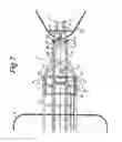 Fig. 07 - Hydrocarbon transfer system with a damped transfer arm