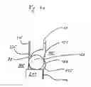 Fig. 06 - Pipette tip, pipette device, and combination of pipette tip and pipette device