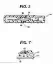 Fig. 04 - Cassette and delivery system