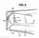 Fig. 08 - Cassette and delivery system