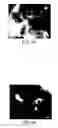 Fig. 05 - Method for producing nano-scale θ-phase alumina microparticles