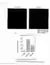 Fig. 05 - Prevention and treatment for GVHD