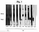 Fig. 04 - Monoclonal antibody against hepatitis E virus or its fragment with binding activity and use thereof