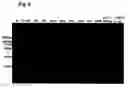 Fig. 07 - Monoclonal antibody against hepatitis E virus or its fragment with binding activity and use thereof