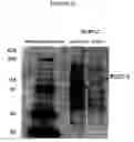 Fig. 20 - Method for isolating BDCA-4+ dendritic cells