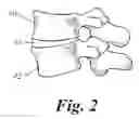 Fig. 03 - Bone growth compositions and methods