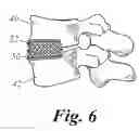 Fig. 07 - Bone growth compositions and methods