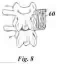 Fig. 09 - Bone growth compositions and methods