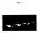 Fig. 10 - Bone growth compositions and methods
