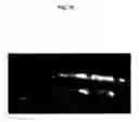 Fig. 11 - Bone growth compositions and methods