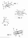 Fig. 02 - Systems and methods providing targeted intraocular drug delivery