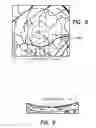 Fig. 03 - Systems and methods providing targeted intraocular drug delivery
