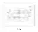 Fig. 04 - Article of clothing for treating a tumor or the like