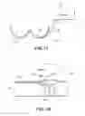 Fig. 16 - Article of clothing for treating a tumor or the like