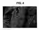 Fig. 07 - Hemostatic devices and methods of making same