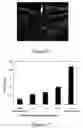 Fig. 11 - Transdermal delivery system for dried particulate or lyophilized medications
