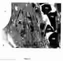 Fig. 10 - Bioactive material for use in stimulating vascularization