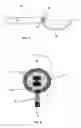 Fig. 02 - Methods and devices for the in situ dissolution of renal calculi