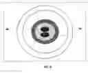 Fig. 05 - Methods and devices for the in situ dissolution of renal calculi