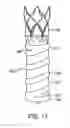 Fig. 08 - PTFE layers and methods of manufacturing