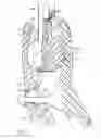 Fig. 07 - Dental articulator extender