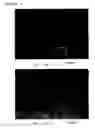 Fig. 02 - Method for detecting and identifying microorganism causative of infection