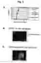 Fig. 03 - Methods for distinguishing type-1 from type-2 diabetes