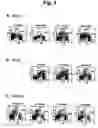 Fig. 04 - Methods for distinguishing type-1 from type-2 diabetes