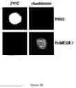 Fig. 06 - Method of screening