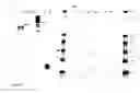 Fig. 07 - DIVA (differentiate infected from vaccinated animals)