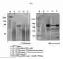 Fig. 03 - Method of selecting strain which highly expresses exogenous genes, mutant strains selected by this method and process for producing enzymes and compounds using the same