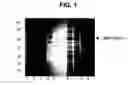 Fig. 02 - Expression of soluble, active eukaryotic glycosyltransferases in prokaryotic organisms